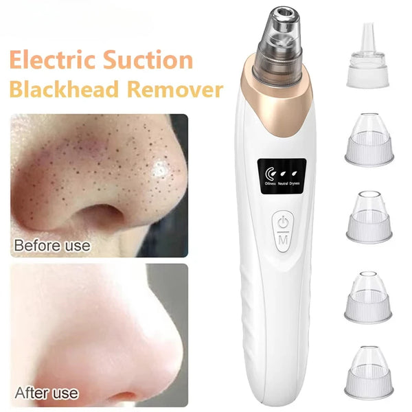 Electric Blackhead Remover Vacuum Cleaner Black Spots Removal Facial Deep Cleansing Pore Cleaner Machine